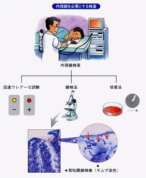 内視鏡を必要とする検査