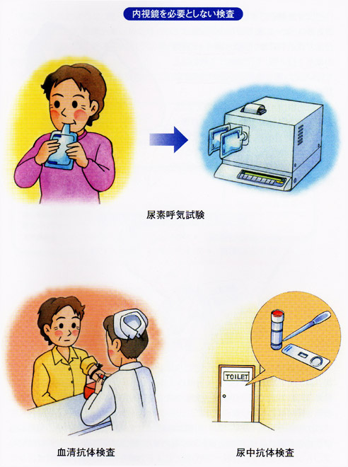 内視鏡を必要としない検査