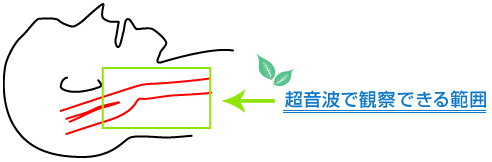 超音波で観察できる範囲